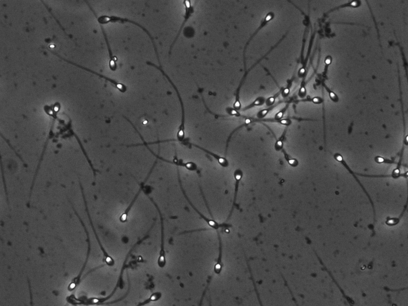 Optimal Phase Contrast Image